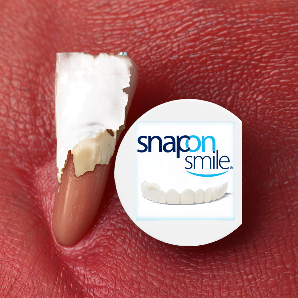 Snap-On Smile
